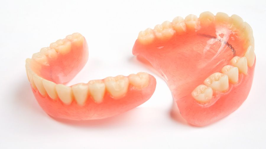 Prótesis dentales fijas